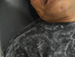 Keluarga Korban Tindak Pidana Penganiayaan di Manggarai Soroti Lambannya Penanganan Kasus